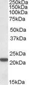 Anti-PSMB8 antibody, C-term used in Western Blot (WB). GTX88410