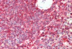 Anti-PSMB8 antibody, C-term used in IHC (Paraffin sections) (IHC-P). GTX88410