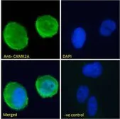 Anti-CaMKII alpha antibody, Internal used in Immunocytochemistry/ Immunofluorescence (ICC/IF). GTX88413