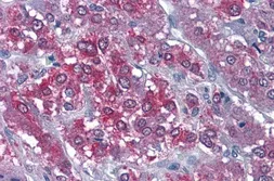 Anti-CaMKII alpha antibody, Internal used in IHC (Paraffin sections) (IHC-P). GTX88413