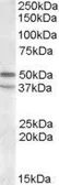 Anti-5-HT7 receptor antibody, C-term used in Western Blot (WB). GTX88414