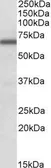 Anti-FMRP (aa116-130) antibody, Internal used in Western Blot (WB). GTX88417