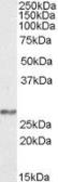 Anti-NDUFS3 antibody, Internal used in Western Blot (WB). GTX88423