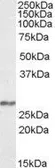 Anti-NDUFS3 antibody, Internal used in Western Blot (WB). GTX88423