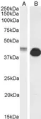 Anti-Connexin 43 antibody, Internal used in Western Blot (WB). GTX88424
