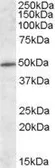Anti-HIPPI antibody, Internal used in Western Blot (WB). GTX88435