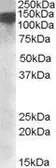 Anti-DHX9 antibody, Internal used in Western Blot (WB). GTX88436