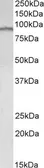 Anti-E2F7 antibody, Internal used in Western Blot (WB). GTX88444