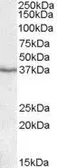 Anti-PON1 antibody, Internal used in Western Blot (WB). GTX88446