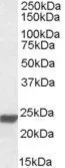 Anti-HMGB3 antibody, Internal used in Western Blot (WB). GTX88447