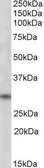 Anti-FHL3 antibody, C-term used in Western Blot (WB). GTX88451