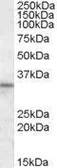 Anti-HAX1 antibody, Internal used in Western Blot (WB). GTX88468