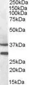 Anti-MC5R antibody, N-term used in Western Blot (WB). GTX88470