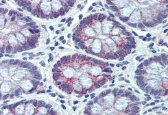 Anti-PXR antibody, Internal used in IHC (Paraffin sections) (IHC-P). GTX88474