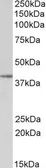 Anti-SFRP4 antibody, Internal used in Western Blot (WB). GTX88477