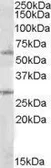 Anti-SOCS7 antibody, Internal used in Western Blot (WB). GTX88488