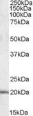Anti-U2AF1L4 antibody, Internal used in Western Blot (WB). GTX88491