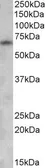 Anti-GAD67 antibody, Internal used in Western Blot (WB). GTX88492