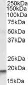 Anti-ARPC4 antibody, Internal used in Western Blot (WB). GTX88495
