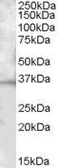Anti-CD272 antibody, C-term used in Western Blot (WB). GTX88506