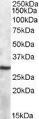 Anti-APOBEC1 antibody, Internal (near N-term) used in Western Blot (WB). GTX88509