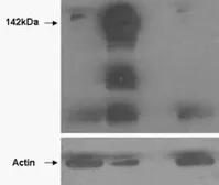 Anti-Tankyrase 1 antibody, N-term used in Western Blot (WB). GTX88517