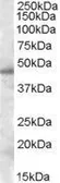 Anti-SEPT7 antibody, Internal used in Western Blot (WB). GTX88524