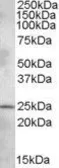 Anti-PHR1 antibody, N-term used in Western Blot (WB). GTX88536