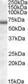 Anti-COL4A3BP (aa396-411) antibody, Internal used in Western Blot (WB). GTX88545