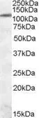 Anti-IRE1 alpha antibody, Internal used in Western Blot (WB). GTX88550