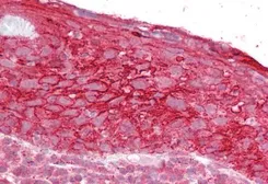 Anti-TACSTD2 antibody, Internal used in IHC (Paraffin sections) (IHC-P). GTX88555