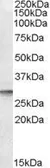Anti-DPM1 antibody, N-term used in Western Blot (WB). GTX88562