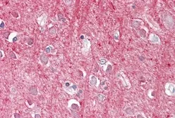 Anti-CD90 antibody, Internal used in IHC (Paraffin sections) (IHC-P). GTX88569