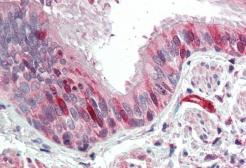 Anti-Calponin 3 antibody, C-term used in IHC (Paraffin sections) (IHC-P). GTX88571
