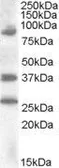 Anti-HOXD10 antibody, Internal used in Western Blot (WB). GTX88572