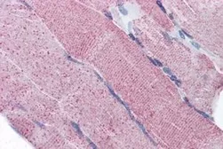 Anti-PACE4 antibody, Internal used in IHC (Paraffin sections) (IHC-P). GTX88576