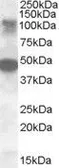 Anti-STK11IP antibody, Internal used in Western Blot (WB). GTX88582