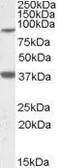 Anti-LASS1 antibody, Internal used in Western Blot (WB). GTX88587
