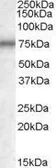 Anti-MEPCE antibody, Internal used in Western Blot (WB). GTX88595