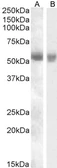 Anti-TMPRSS2 antibody, Internal used in Western Blot (WB). GTX88625