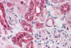 Anti-ABCD4 antibody, Internal used in IHC (Paraffin sections) (IHC-P). GTX88637