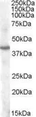 Anti-PITX3 antibody, Internal used in Western Blot (WB). GTX88644