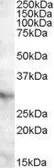 Anti-APOA1BP antibody, C-term used in Western Blot (WB). GTX88646