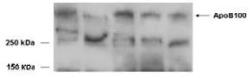 Anti-Apolipoprotein B antibody, Internal used in Western Blot (WB). GTX88654