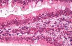 Anti-Apolipoprotein B antibody, Internal used in IHC (Paraffin sections) (IHC-P). GTX88654