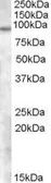 Anti-TCHHL1 antibody, Internal used in Western Blot (WB). GTX88664