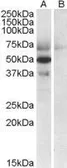 Anti-Apolipoprotein L4 antibody, C-term used in Western Blot (WB). GTX88671