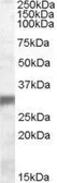 Anti-PHD3 antibody, Internal used in Western Blot (WB). GTX88678
