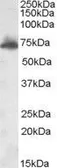Anti-AKAP10 antibody, Internal used in Western Blot (WB). GTX88680