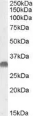 Anti-OTUB1 antibody, Internal used in Western Blot (WB). GTX88681